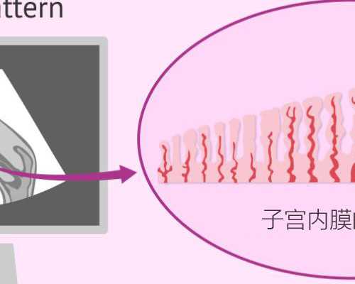 做试管卵巢功能如何检查 试管查卵巢功能抽血多长时间出结果